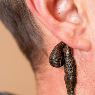 Tinnitus - auch Akutbehandlung bei Hörsturz
